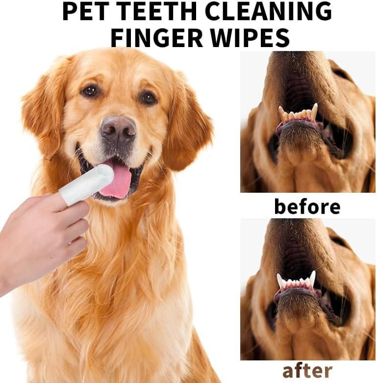 Disposable Dental Finger Wipes