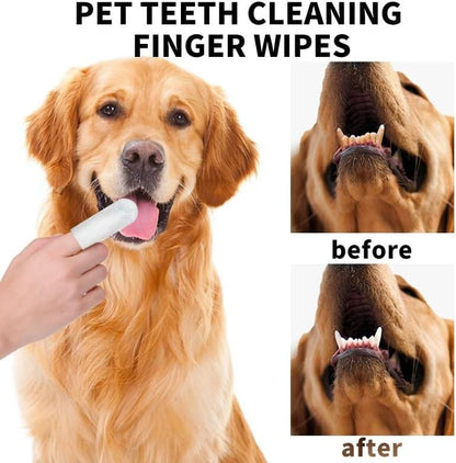 Disposable Dental Finger Wipes